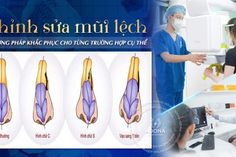 Chỉnh sửa mũi lệch: Phương pháp khắc phục cho từng trường hợp cụ thể