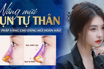 Nâng mũi sụn tự thân – Giải pháp vàng cho dáng mũi hoàn hảo
