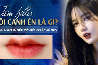 Tiêm môi cánh én là gì? Những cách sở hữu đôi môi quyến rũ hơn