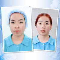 Điều Trị Nhược Cơ