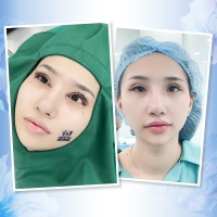 Sửa Lại Mí Hỏng