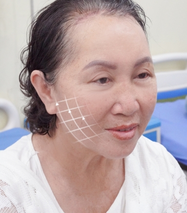 Thẩm mỹ mũi